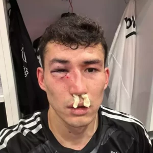 Зайнутдинов госпитализирован после получения травмы в матче с "Башакшехиром"