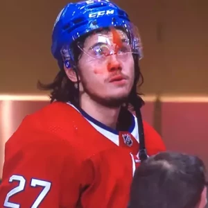 Российский хоккеист Романов сломал нос в матче НХЛ