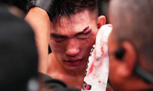 Кори Сэндхаген победил Сун Ядуна после того, нанес ему ужасную сечку, которая привела к остановке врача на турнире UFC Vegas 60